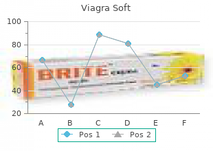 viagra soft 50 mg generic