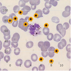 Van Bogaert Hozay syndrome